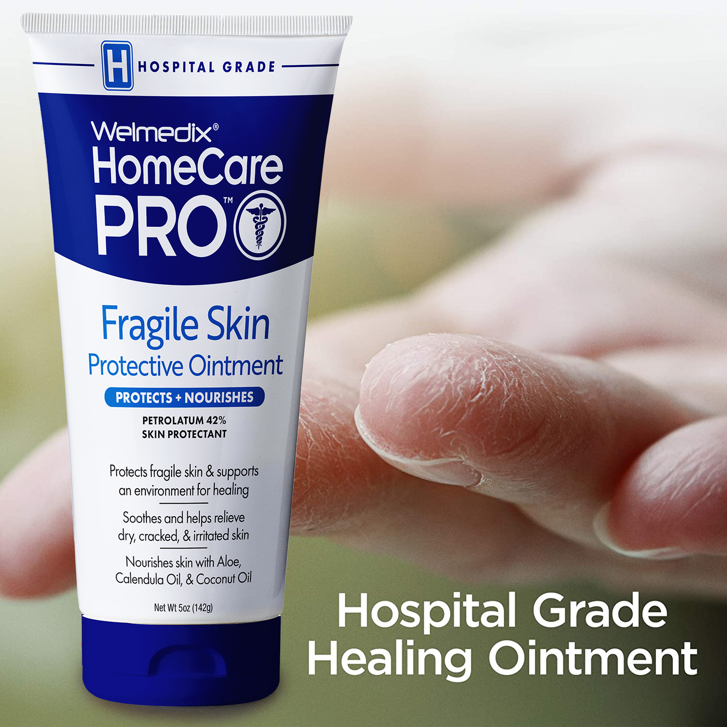 Protective Ointment for Thin & Fragile Skin